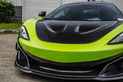 Buy Now AUTHENTIC DARWINPRO CARBON HOOD BONNET for MCLAREN 540C 570S 570GT 600LT 2015 - 2021 P1 Style and upgrade car parts from SIR Tuning at the Best Price. Headlights, Tail lights, Bodykits, Navigations, body kit and more - Fast & Free Shipping within Europe, US & Worldwide.
