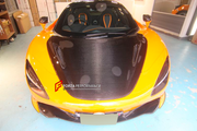 Buy Now CARBON HOOD BONNET for MCLAREN 720S COUPE 2017 - 2023 and upgrade car parts from SIR Tuning at the Best Price. Headlights, Tail lights, Bodykits, Navigations, body kit and more - Fast & Free Shipping within Europe, US & Worldwide.